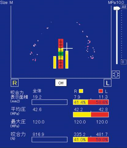 咬合圧測定器